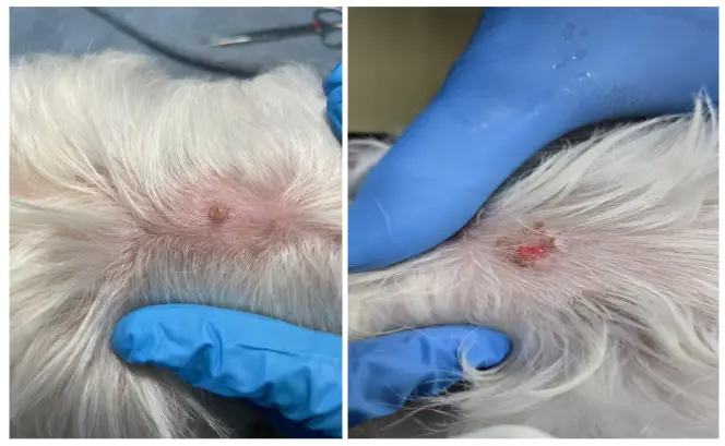 Crioterapia-casoclinico1