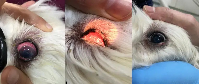 Crioterapia-casoclinico2